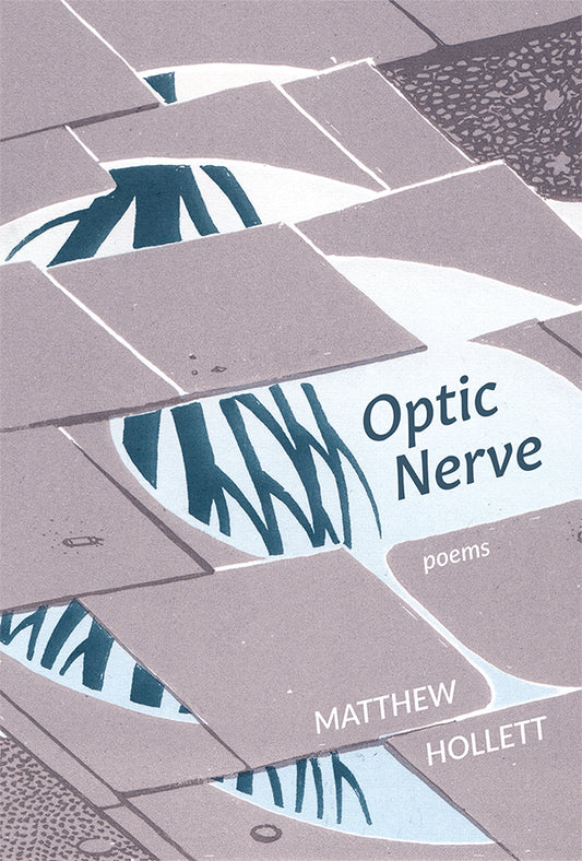 Optic Nerve by Matthew Hollett